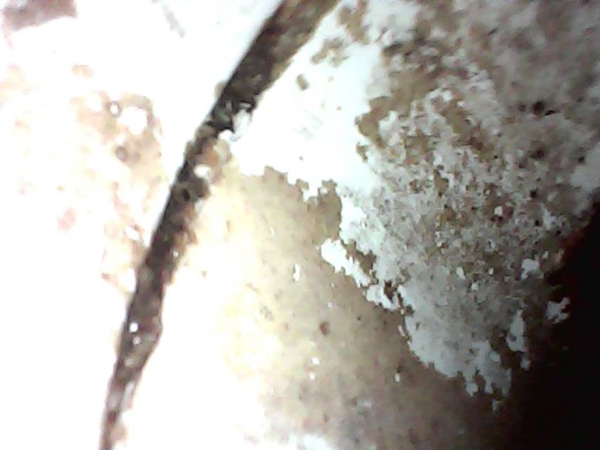成都锦江区 内窥镜检查：管道内侧状态